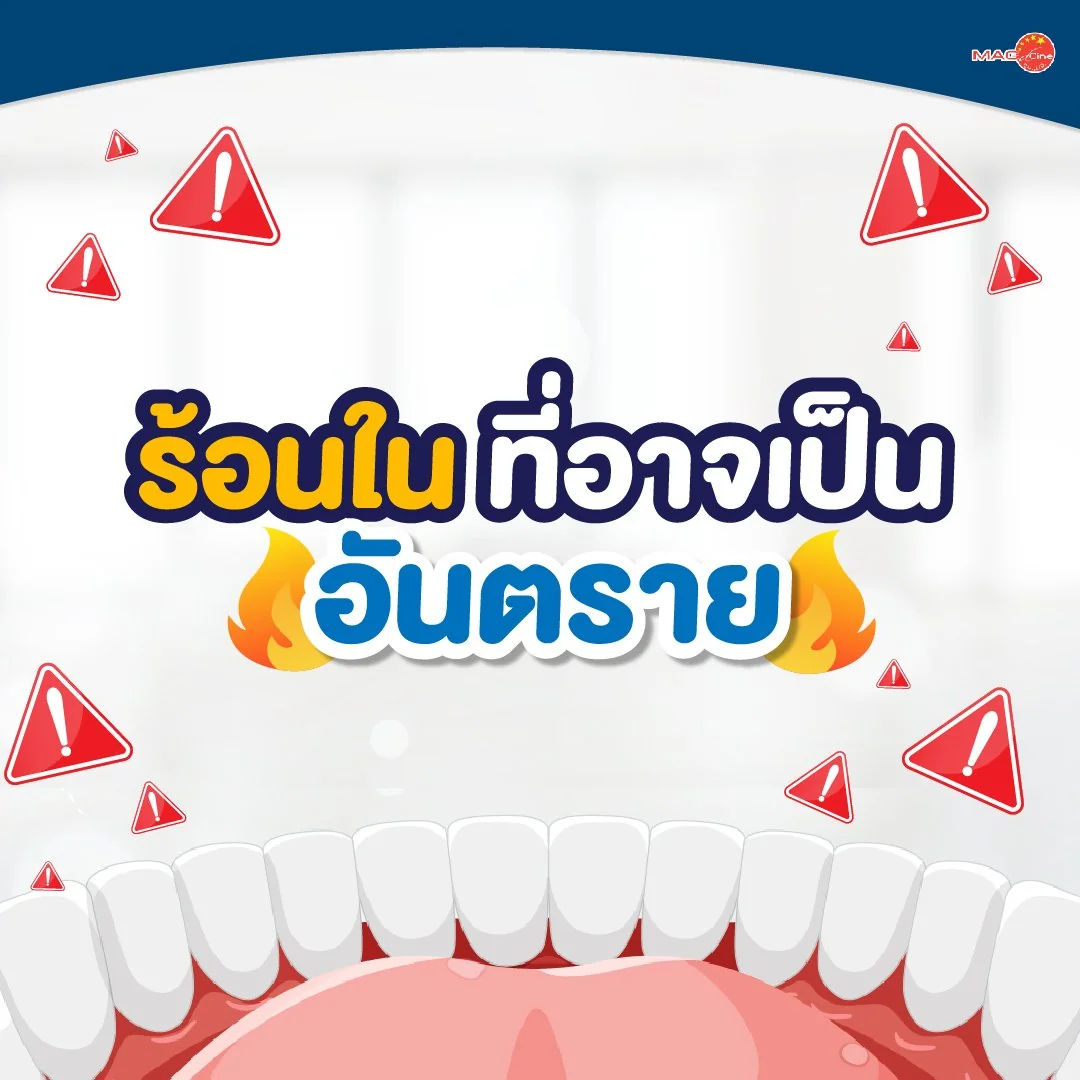 ร้อนในที่เป็นอันตราย
