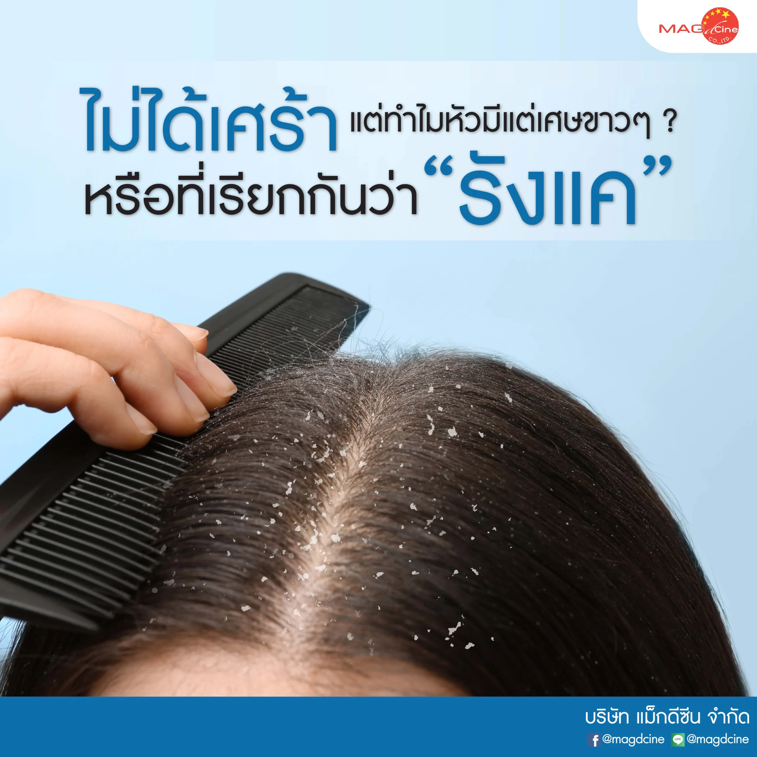 ชุดตรวจสารเสพติด ที่ตรวจสารเสพติด ชนิดจุ่ม ชนิดหยด เครื่องมือทางการแพทย์ 107 อาการ "ไม่ได้เศร้า แต่ทำไมหัวมีแต่เศษขาวๆ" หรือที่เรียกกันว่า "รังแค" แก้ได้ด้วย ทาร์แชมพู
