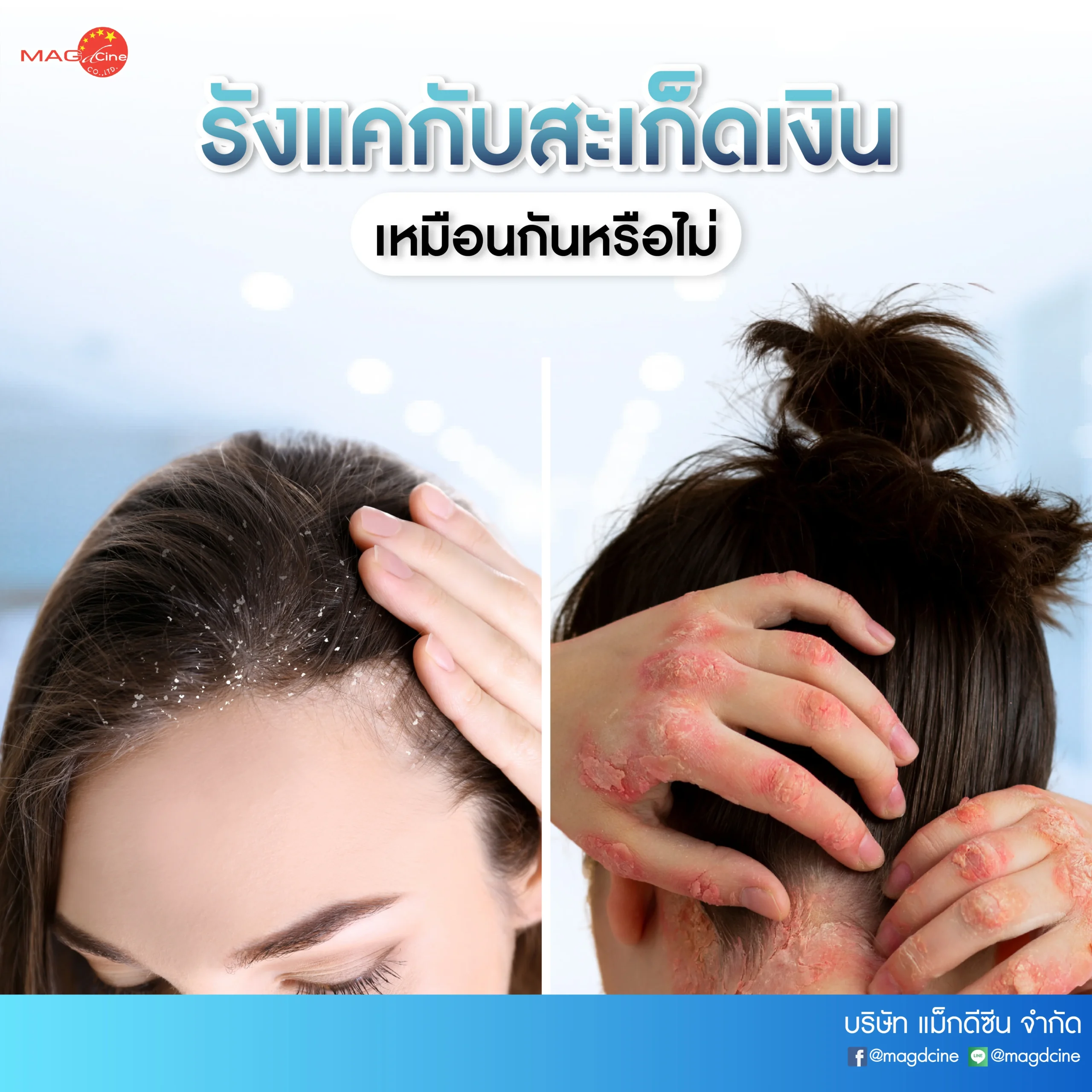ชุดตรวจสารเสพติด ที่ตรวจสารเสพติด ชนิดจุ่ม ชนิดหยด เครื่องมือทางการแพทย์ 105 21 scaled ชุดตรวจสารเสพติด ที่ตรวจสารเสพติด ชนิดจุ่ม ชนิดหยด เครื่องมือทางการแพทย์