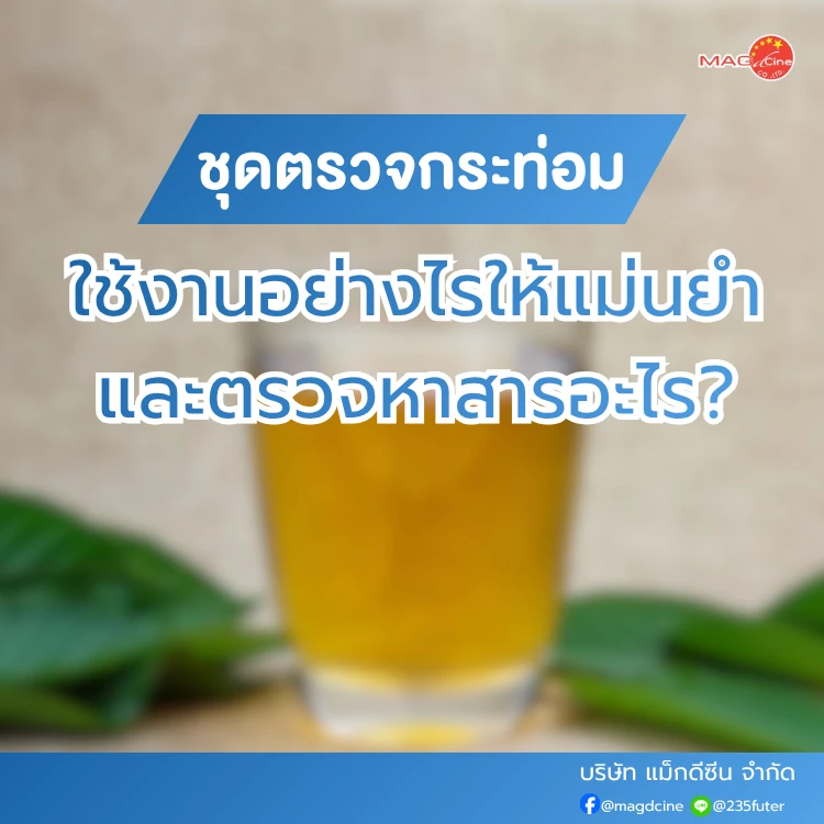 ชุดตรวจกระท่อมคืออะไร